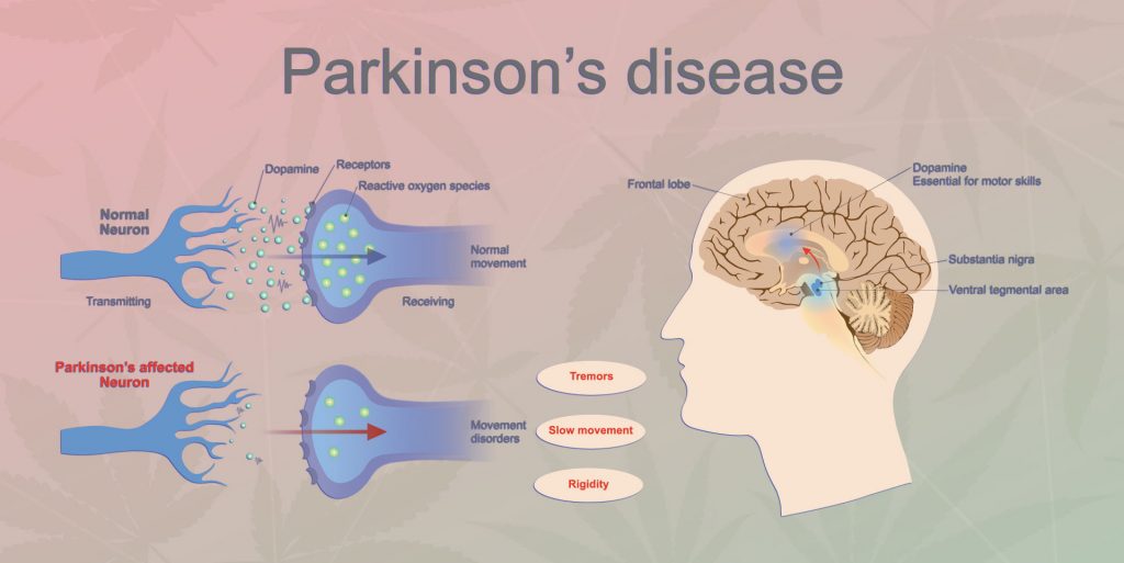 Parkinson's marijuana
